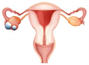 Vector graphic of a uterus with ovaries in which one is infected with cancer.